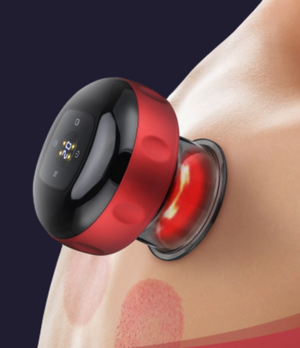 Electric Suction Cupping Massager - Grow Healthy Australia 